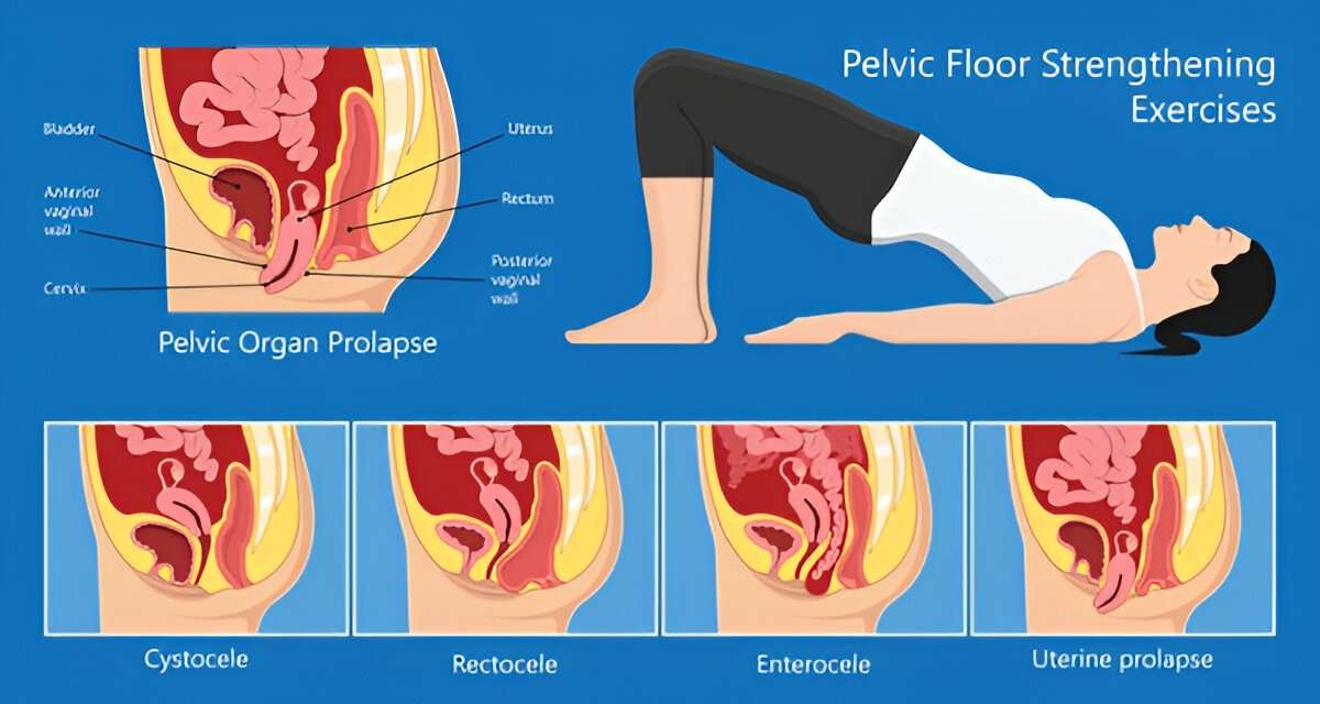 Erectile Dysfunction Exercises